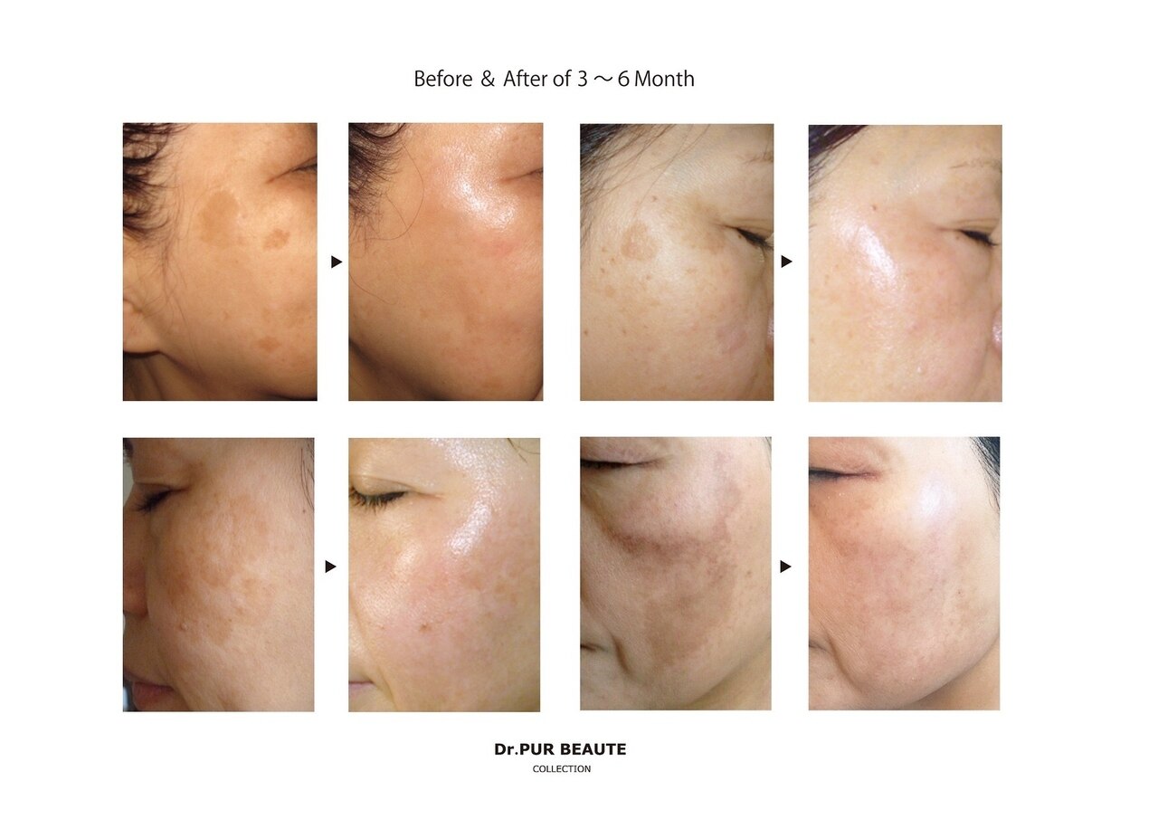 福岡市中央区で光フェイシャルが人気のエステサロン｜ホットペッパー