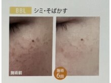 アリュール(Allure)の雰囲気（ルミクスかそれ以外か。爆抜けモード搭載機はAllureだけ☆）