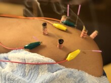 オーダーメイド施術始めました！詳細はクーポンをご覧ください。