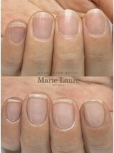 マリーロール 天王寺店(Marie Laure)/自爪育成/深爪矯正/ネイルケア