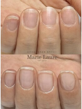 マリーロール 天王寺店(Marie Laure)/自爪育成/深爪矯正/ネイルケア