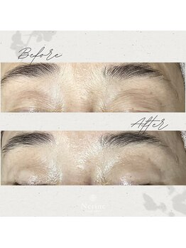 ネリネ(Nerine)/生プラセンタフェイシャル