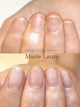 マリーロール 淀屋橋本店(Marie Laure)/自爪育成/深爪矯正/ネイルケア