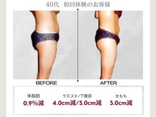 プレステージ 横須賀中央店/マッサージ◆ビフォーアフター