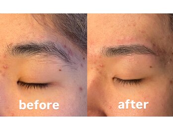トップルック 横浜店(TOP LOOK)/メンズ眉毛ビフォーアフター
