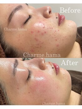 シャルム(Charme.)/