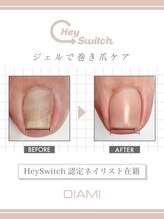 エム ネイル(M nail) 巻爪ケア ジェル