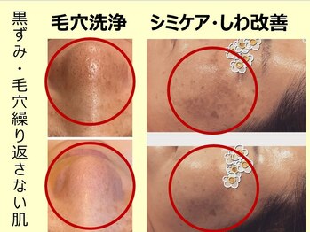 くつろぎ処癒家/オーダーメイドフェイシャル