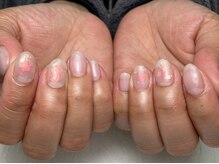 ブルーム(Bloom)/定額デザイン