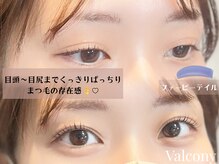 バルコニー(valcony)/まつげパーマ+4種TR美容液仕上げ