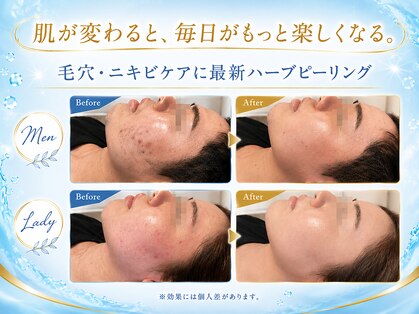 レン(Ren)の写真