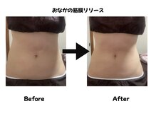 クオーレ(Quale)/おなかの筋膜リリース