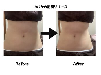 クオーレ(Quale)/おなかの筋膜リリース