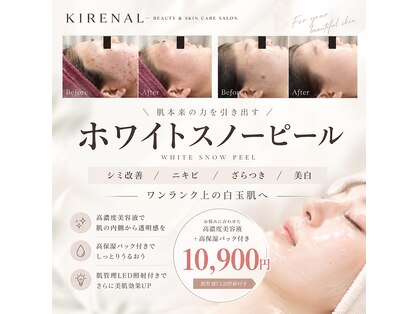 キレナル(KIRENAL)の写真