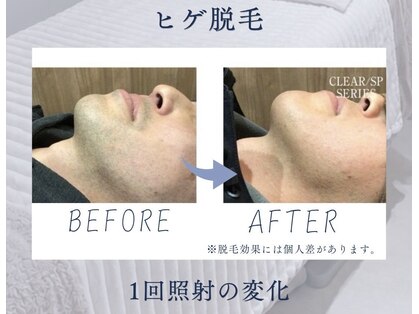 アールビーオム 六本木(RB HOMMU)の写真