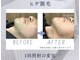アールビーオム 六本木(RB HOMMU)の写真