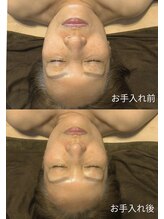 そら/小顔　ヘッドマッサージ