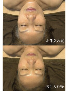 そら/小顔　神経整体