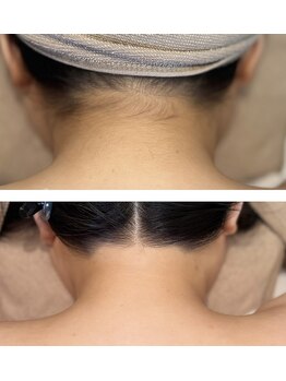 アドビューティ(Add Beauty)/花嫁様プラン／ブライダルエステ