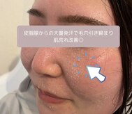 ヨサパーク スリー 西日暮里(YOSA PARK three)