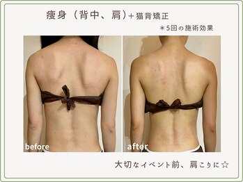 べセラ(BESERA)/痩身・ブライダルエステ