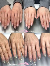 セラ 天神(Cela)/パラフィンパック症例☆補正無し