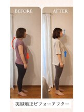 ブリリアントスマイル/姿勢で変わる小顔