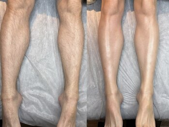 ラズリ(LAZULI)の写真/メンズも大歓迎！眉毛からBodyまで、エチケットとして一次的な脱毛をご希望の方も安心サポート◎