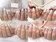 ミニョンネイル(mignon nail)の写真