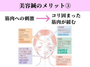 ビシンラボ(美SIN LAB)/美容鍼3:コリ固まった筋肉緩む