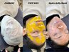【3月限定・フェイシャル】カーボキシー+全顔WAX脱毛+Hydro Jelly Mask 