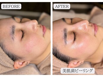 ルミア 函館店(LuMia)/美肌菌を増やし肌免疫を底上げ!