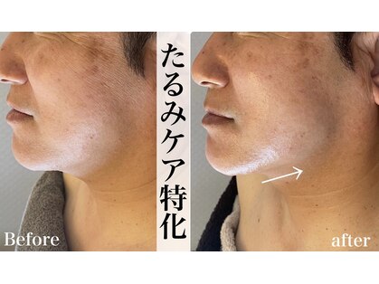 アリイ(Alii)の写真