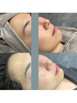 レベンディス(LEVENDIS)/ララピール