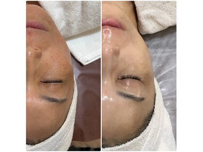 オージャス(OJAS)の写真