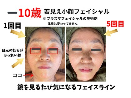 トータルビューティー雅の写真