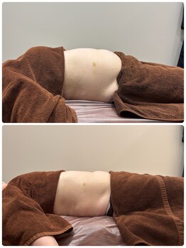 ビアンジュ(biange)の写真/内側からの冷え改善・代謝アップをサポート！腸もみで驚きの浮腫み改善効果を実感！☆