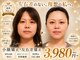 モアフェイス 池袋店(More Face)の写真/◆劇的アフター効果に自信あり◆オールハンド【頬骨フェイスライン矯正/リンパ矯正/首肩矯正】60分3980円～
