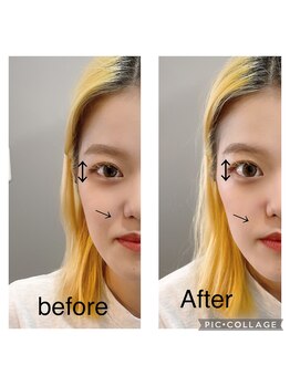 エンチャント(ENCHANT)/顔特化