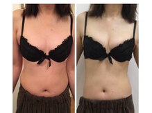 ベルビューティー(belle beauty)/バストアップ体験のお客様の変化