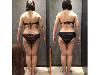 フローボディ 新山口店(flow BODY)/山口のエステはflow BODY