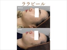 ティアム バイ テトテ 神戸三宮(TIAM by tetote)/ララピール