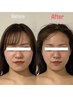 【lady's】オールハンド式 小顔矯正40分9000円→7000円