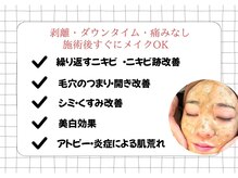 リセットプラス(Reset+)/肌質改善ハーブピーリング