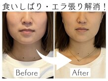 美骨製作所アクア(aqua)