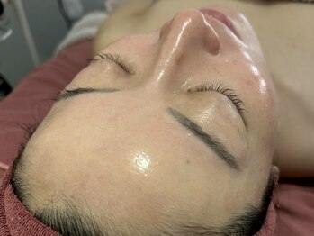 ハートフル ビューティー(HEARTFUL BEAUTY)の写真/痛みが少ない【高濃度鎮静ピーリング】!極上の艶肌で根本からお肌悩みを予防ケア☆お悩みを根本改善へ☆