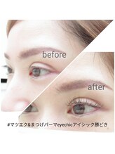 アイシック 勝どき(eyechic)/マツエク勝どき月島　LED取扱