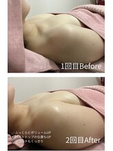 チュラ 大宮店(Chura)/【30代】バストアップ2回目@大宮