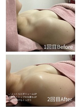 チュラ 大宮店(Chura)/【30代】バストアップ2回目@大宮