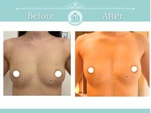 美人バスト 新潟店/ 【バストアップ★育乳】症例